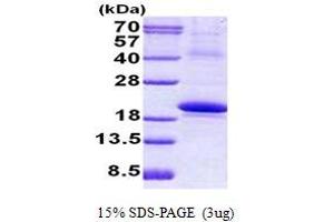 Image no. 1 for Interleukin 18 Binding Protein (IL18BP) protein (His tag) (ABIN1098760)