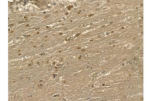 LBX1 Mouse Monoclonal Antibody at 1/100 staining rat brain tissue by IHC-P. (Lbx1 抗体)