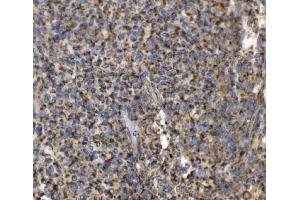 IHC analysis of MRPS25 using anti-MRPS25 antibody (ABIN7599032).
