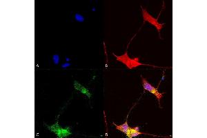 Immunocytochemistry/Immunofluorescence analysis using Mouse Anti-SHANK (pan) Monoclonal Antibody, Clone S23b-49 (ABIN2484053).