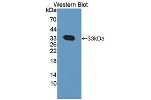 Western blot analysis of the recombinant protein. (CAPNL1 抗体  (AA 75-356))