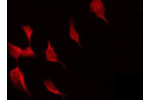 ABIN6274324 staining COLO205 by IF/ICC. (Meningioma 1 抗体  (Internal Region))