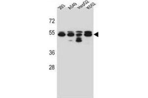 Western Blotting (WB) image for anti-Tubulin, beta 8 (TUBB8) antibody (ABIN2997238) (Tubulin, beta 8 抗体)