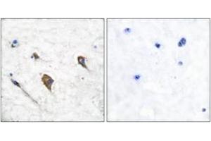 Immunohistochemistry analysis of paraffin-embedded human brain, using IL-3R beta (Phospho-Tyr593) Antibody.