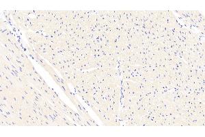 Detection of CTGF in Human Cardiac Muscle Tissue using Polyclonal Antibody to Connective Tissue Growth Factor (CTGF) (CTGF 抗体  (AA 248-349))
