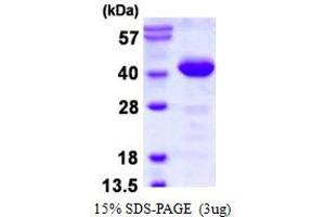 Phosducin-Like (PDCL) (AA 1-301) protein (His tag)
