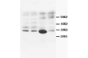 Western Blotting (WB) image for anti-Calbindin (CALB1) antibody (ABIN1105634) (CALB1 抗体)