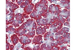 Immunohistochemistry (IHC) image for anti-FEZ Family Zinc Finger 1 (FEZF1) (C-Term) antibody (ABIN2784171) (FEZF1 抗体  (C-Term))