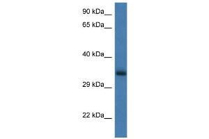 WB Suggested Anti-Gnpda1 Antibody   Titration: 1. (GNPDA1 抗体  (N-Term))