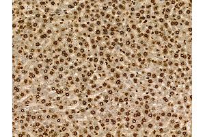 Phospho-SGK1 (Ser78) Antibody at 1/100 staining Rat liver tissue by IHC-P. (SGK1 抗体  (pSer78))