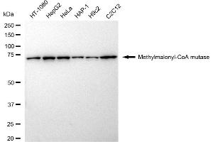 Western blotting analysis using Methylmalonyl-CoA mutase antibody (ABIN7799395). (Recombinant MUT 抗体)