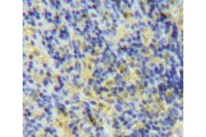 IHC-P analysis of spleen tissue, with DAB staining. (LY75/DEC-205 抗体  (AA 216-503))