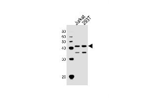 All lanes : Anti-ETS1 Antibody (N-term) at 1:1000 dilution Lane 1: Jurkat whole cell lysates Lane 2: 293T whole cell lysates Lysates/proteins at 20 μg per lane. (ETS1 抗体  (N-Term))