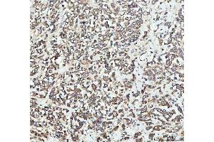 IHC analysis of EEA1 using anti-EEA1 antibody (ABIN5692856). (EEA1 抗体)