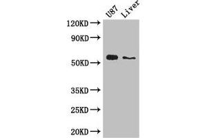 Western Blot Positive WB detected in: U87 whole cell lysate, Mouse liver tissue All lanes: ALDH1A3 antibody at 3 μg/mL Secondary Goat polyclonal to rabbit IgG at 1/50000 dilution Predicted band size: 57 kDa Observed band size: 57 kDa (ALDH1A3 抗体  (AA 2-210))