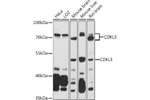Western blot analysis of extracts of various cell lines, using CDKL3 antibody (ABIN7266612) at 1:1000 dilution. (CDKL3 抗体  (AA 1-120))