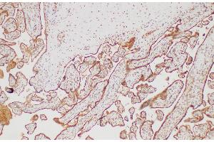 Immunohistochemistry of paraffin-embedded Human placenta using FGG Polycloanl Antibody at dilution of 1:200 (FGG 抗体)