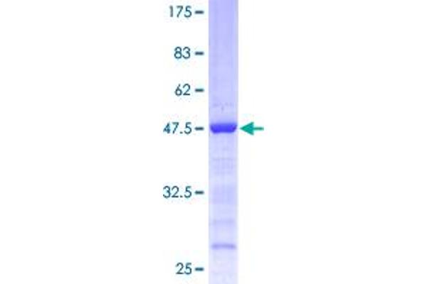 EIF1AY Protein (AA 1-144) (GST tag)