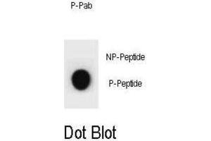 Dot Blot (DB) image for anti-Cyclin B2 (CCNB2) (pSer392) antibody (ABIN3002074) (Cyclin B2 抗体  (pSer392))