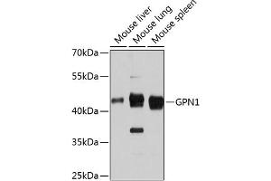 Western blot analysis of extracts of various cell lines, using GPN1 antibody (ABIN6133308, ABIN6141341, ABIN6141342 and ABIN6215758) at 1:3000 dilution. (GPN1 抗体  (AA 269-388))