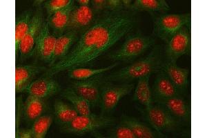 IF analysis of Daxx using anti-Daxx antibody (ABIN3043822) and anti-Tubulin Alpha antibody (ABIN7600339). (DAXX 抗体  (AA 56-345))