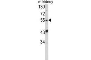 Western blot analysis of SIL1 Antibody (Center) in mouse kidney tissue lysates (35ug/lane). (SIL1 抗体  (Middle Region))