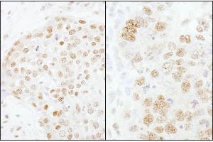 Immunohistochemistry (IHC) image for anti-Cleavage and Polyadenylation Specific Factor 3, 73kDa (CPSF3) (AA 634-684) antibody (ABIN7451720)