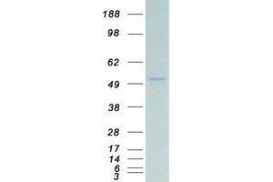 Western Blotting (WB) image for Paired Box 8 (PAX8) protein (Myc-DYKDDDDK Tag) (ABIN2728324)