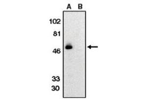 Image no. 1 for anti-Chemokine (C-X3-C Motif) Receptor 1 (CX3CR1) (AA 175-189) antibody (ABIN265002) (CX3CR1 抗体  (AA 175-189))