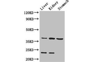 Western Blot Positive WB detected in: Mouse liver tissue, Mouse kidney tissue, Mouse stomach tissue All lanes: Akr1a1 antibody at 2. (AKR1A1 抗体  (AA 2-325))