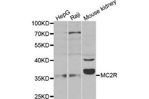 Western blot analysis of extracts of 293 cell lysate, using MC2R antibody. (MC2R 抗体)