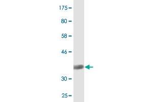 Western Blot detection against Immunogen (37. (SIAH1 抗体  (AA 1-110))