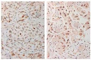 Immunohistochemistry (IHC) image for anti-Ataxia Telangiectasia Mutated (ATM) (AA 1974-1988), (pSer1981) antibody (ABIN6656104)