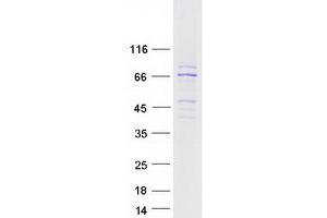 Western Blotting (WB) image for CaM Kinase-Like Vesicle-Associated (CAMKV) protein (Myc-DYKDDDDK Tag) (ABIN2713101)