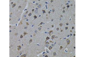 Immunohistochemistry of paraffin-embedded Rat brain using ERBB3 Polyclonal Antibody at dilution of 1:100 (40x lens). (ERBB3 抗体)