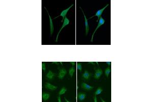 ICC/IF analysis of CSTB in U87MG cells line, stained with DAPI (Blue) for nucleus staining and monoclonal anti-human CSTB antibody (1:100) with goat anti-mouse IgG-Alexa fluor 488 conjugate (Green). (CSTB 抗体  (AA 1-98))
