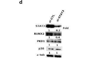 PKD1 impaired osteoblast differentiation through JAK1/STAT3 and p38 signaling pathway.