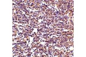 Immunohistochemistry (IHC) image for anti-CD180 Molecule (CD180) (Middle Region) antibody (ABIN1031073) (CD180 抗体  (Middle Region))