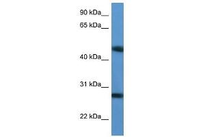Western Blot showing TM2D2 antibody used at a concentration of 1-2 ug/ml to detect its target protein. (TM2D2 抗体  (Middle Region))
