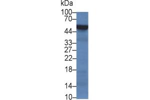 Western Blotting (WB) image for Orosomucoid 1 (ORM1) ELISA Kit (ABIN6574213)
