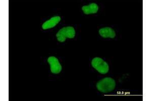 Immunofluorescence of purified MaxPab antibody to ZNF502 on HeLa cell. (ZNF502 抗体  (AA 1-544))