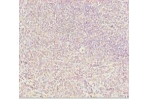 Immunohistochemistry of paraffin-embedded human tonsil tissue using ABIN7144962 at dilution of 1:100 (DDX11 抗体  (AA 1-220))