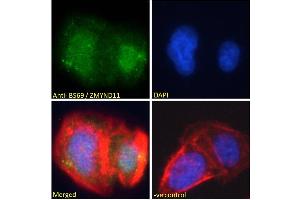 ABIN184908 Immunofluorescence analysis of paraformaldehyde fixed U2OS cells, permeabilized with 0. (ZMYND11 抗体  (N-Term))