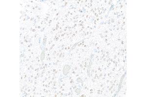 Immunohistochemistry (IHC) image for anti-SRY (Sex Determining Region Y)-Box 2 (SOX2) antibody (ABIN7449421) (SOX2 抗体)