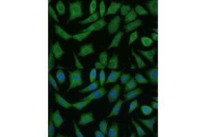 Immunofluorescence analysis of L929 cells using DRG2 antibody (ABIN7266746) at dilution of 1:100. (DRG2 抗体  (AA 150-260))