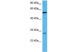 Host:  Mouse  Target Name:  RBPJ  Sample Tissue:  Mouse Liver  Antibody Dilution:  1ug/ml (RBPJ 抗体  (C-Term))
