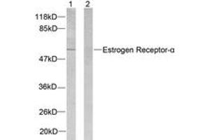 Western blot analysis of extracts from 293 cells, treated with Forskolin, using Estrogen Receptor-alpha (Ab-104) Antibody. (Estrogen Receptor alpha 抗体  (AA 81-130))