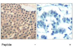 Image no. 1 for anti-HDAC4,HDAC5,HDAC9 (Ser220), (Ser246), (Ser259) antibody (ABIN319389) (HDAC4/HDAC5/HDAC9 抗体  (Ser220, Ser246, Ser259))