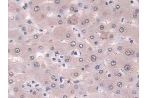 Immunohistochemistry (IHC) image for anti-Proteasome (Prosome, Macropain) Subunit, beta Type, 8 (Large Multifunctional Peptidase 7) (PSMB8) (AA 75-261) antibody (ABIN7440236)