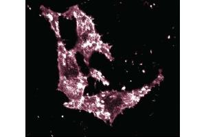 Immunofluorescent staining of HeLa cells with anti-Ezrin antibody. (Ezrin 抗体  (AA 391-515))